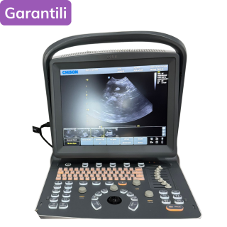 Chıson ECO3 Ultrason Cihazı