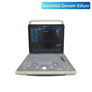 Mindray dp50 Ultrason Cihazı
