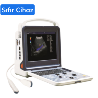K6 Tam Dijital Renkli Ultrason Cihazı